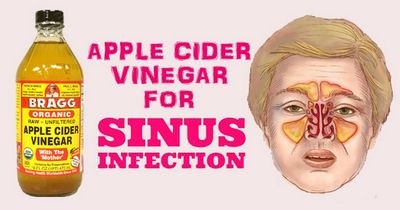 Home Remedies For Sinus Problems - The Best Ways to Treat Them