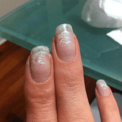 How To Remove White Spots On Nails 