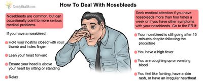 What Causes Nose Bleeds?